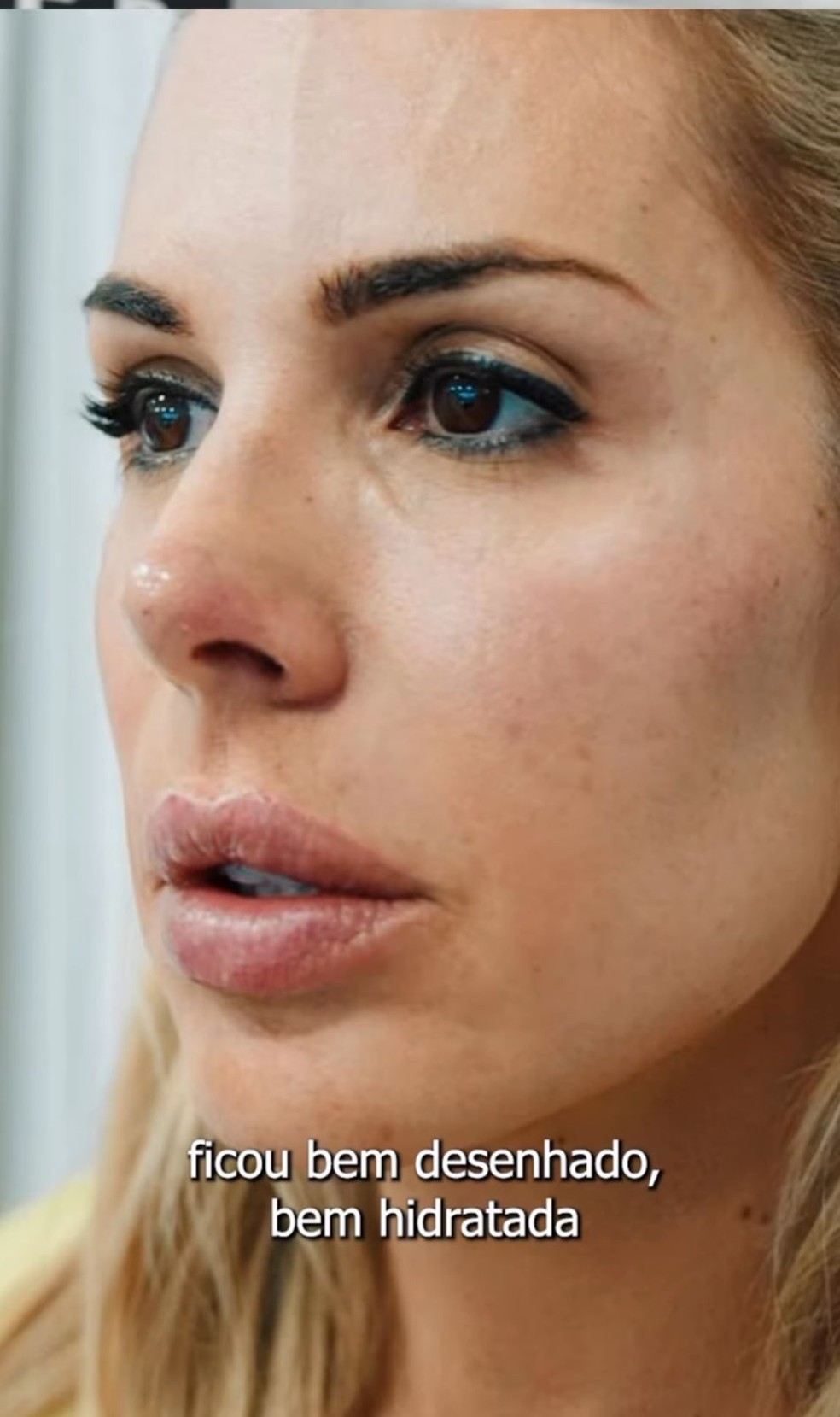 Ex-Feiticeira, Joana Prado faz harmonização facial — Foto: Instagram