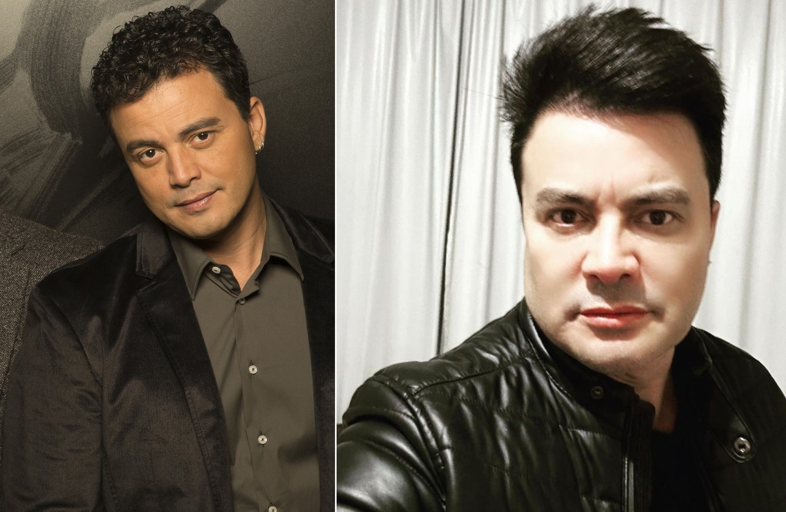 Antes e depois: sertanejo Renner mostra resultado da harmonização facial — Foto: Divulgação/Instagram