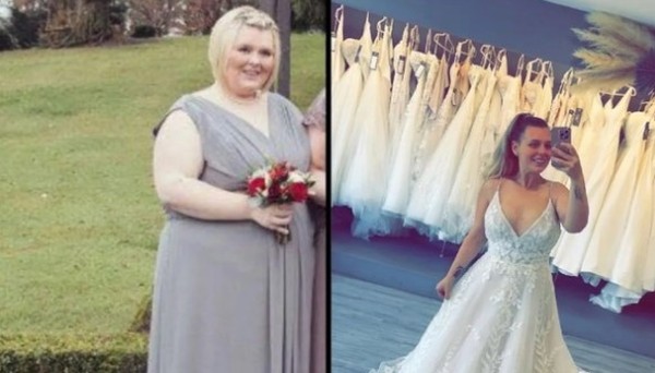 De madrinha com 152kg a noiva com 57kg: inglesa se tornou influencer de cirurgias