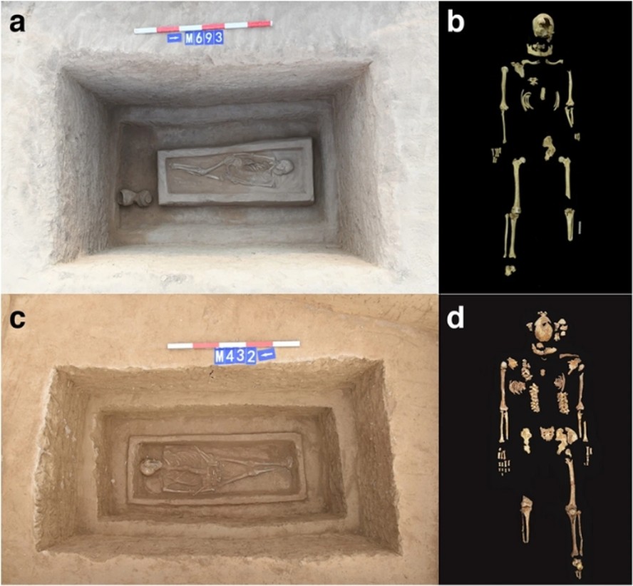 Os túmulos e esqueletos do homem com amputação da perna esquerda (a-b) e do homem com amputação da perna direita (c-d).