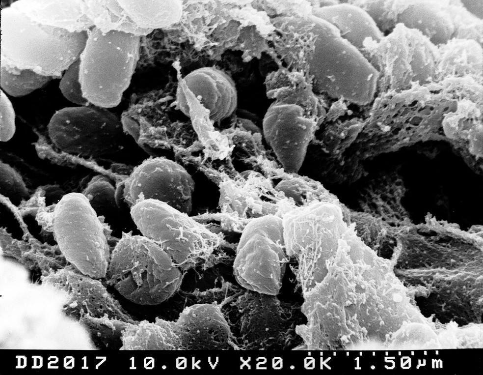 Micrografia eletrônica de varredura representando massa de bactérias Yersinia pestis no intestino anterior do vetor da pulga  — Foto: NIAID