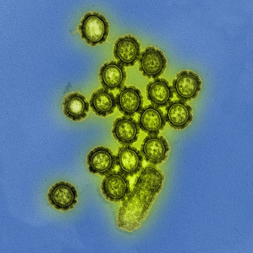 Micrografia eletrônica de transmissão colorida mostrando partículas do vírus influenza H1N1. As proteínas de superfície nas partículas do vírus são mostradas em preto — Foto: NIAID