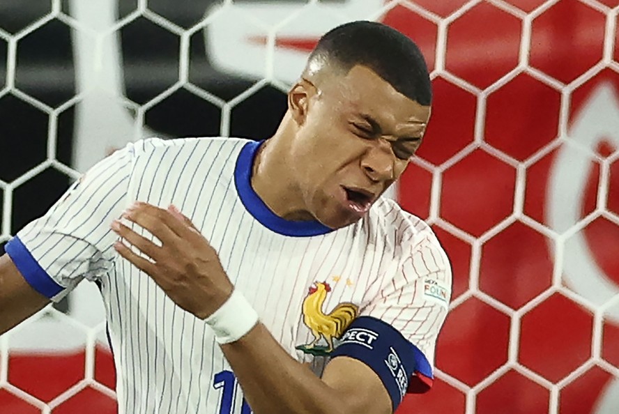 Mbappé fraturou o nariz no jogo contra a Áustria