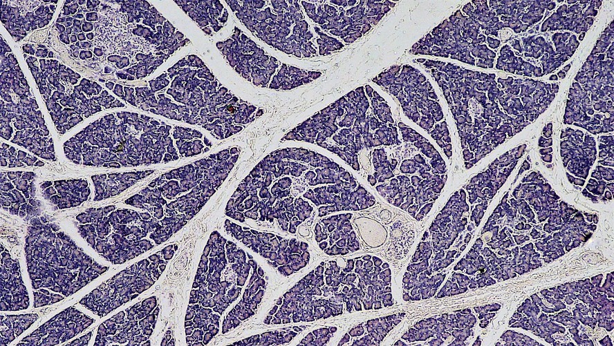 Células do pâncreas vistas em microscópio; órgão é vulnerável a um dos tipos mais agressivos de câncer