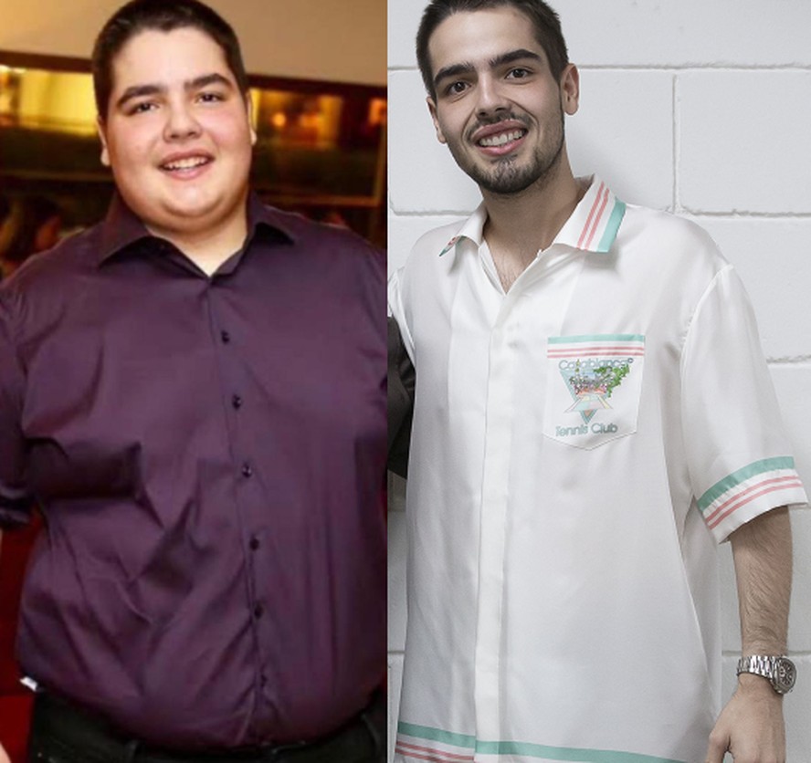 João Silva antes e depois da cirurgia bariátrica