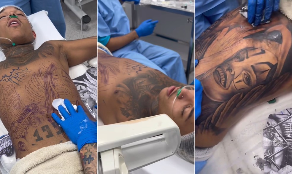 DJ é sedado para realizar tatuagem. — Foto: Reprodução / Instagram