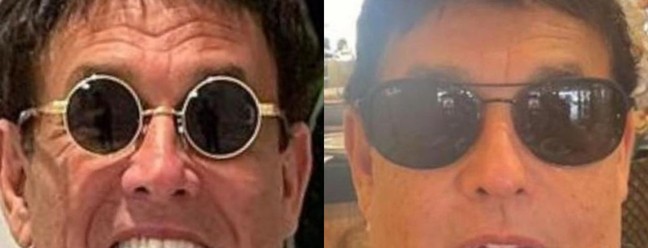 Harmonização facial: antes e depois de Sérgio Malandro — Foto: Reprodução Instagram