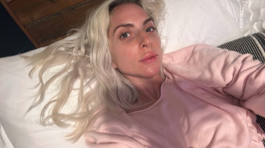 Lady Gaga posou sem maquiagem e exibiu beleza natural em foto — Foto: Reprodução Instagram