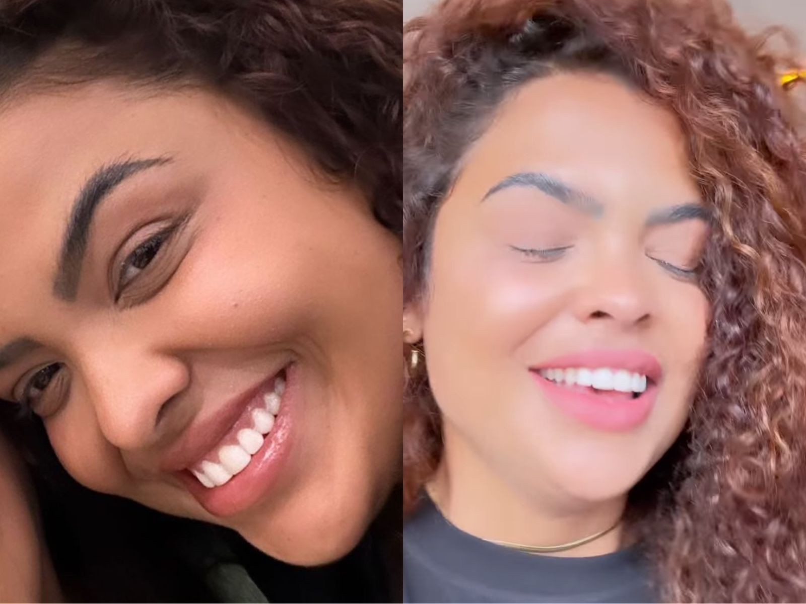 Além disso, a ex-participante já havia realizado harmonização facial e preenchimento labial. Agora, ela está modificando o sorriso e trocou as facetas dos dentes — Foto: Reprodução/Instagram