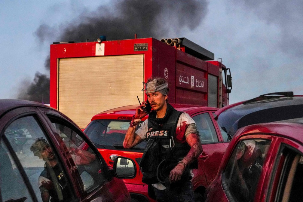 Cinegrafista da AFP, Dylan Collins, ferido por um bombardeio israelense na fronteira entre Líbano e Israel — Foto: Hassan Ammar/AFP