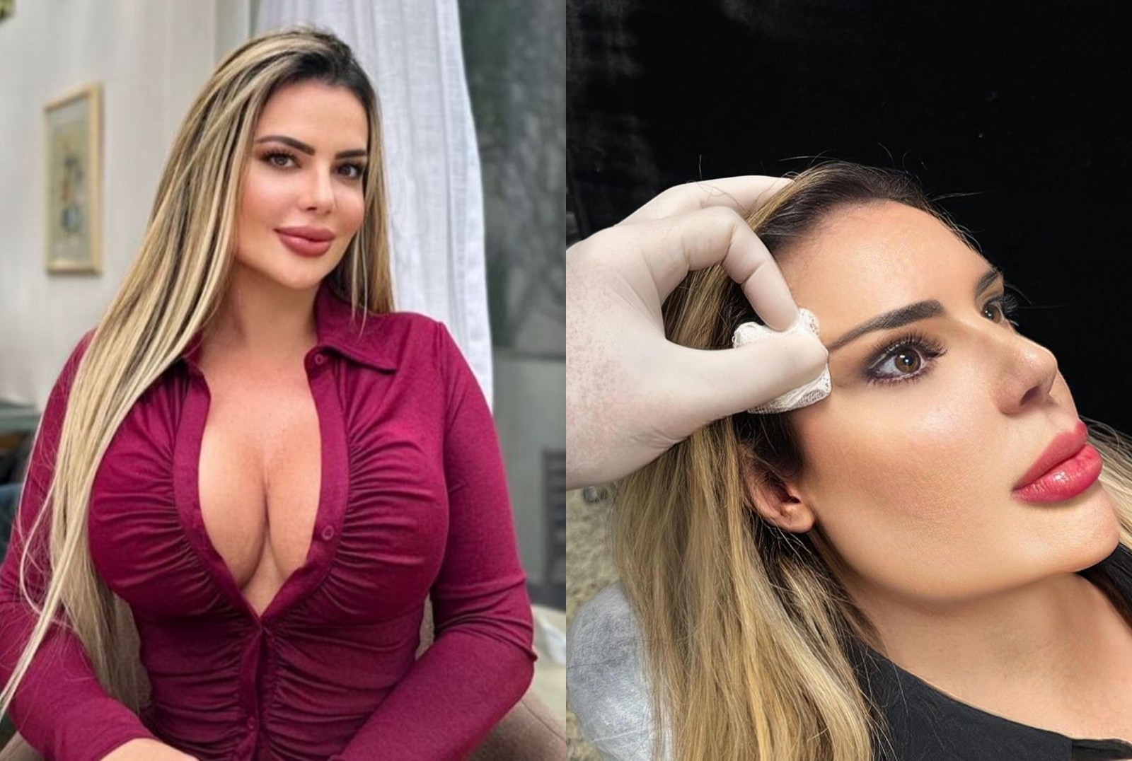 A criadora de conteúdo Denise Rocha se submeteu ao procedimento 'olhos de raposa' — Foto: Reprodução Instagram