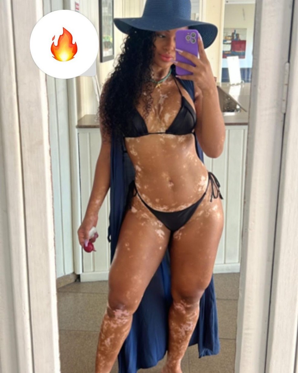 Ex-BBB Natália Deodato revelou que emagreceu 7 kg — Foto: Reprodução Instagram