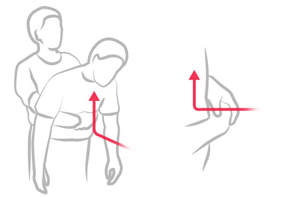 Manobra Heimlich com a pessoa consciente em pé ou sentada. Exercendo força — Foto: Arte O Globo