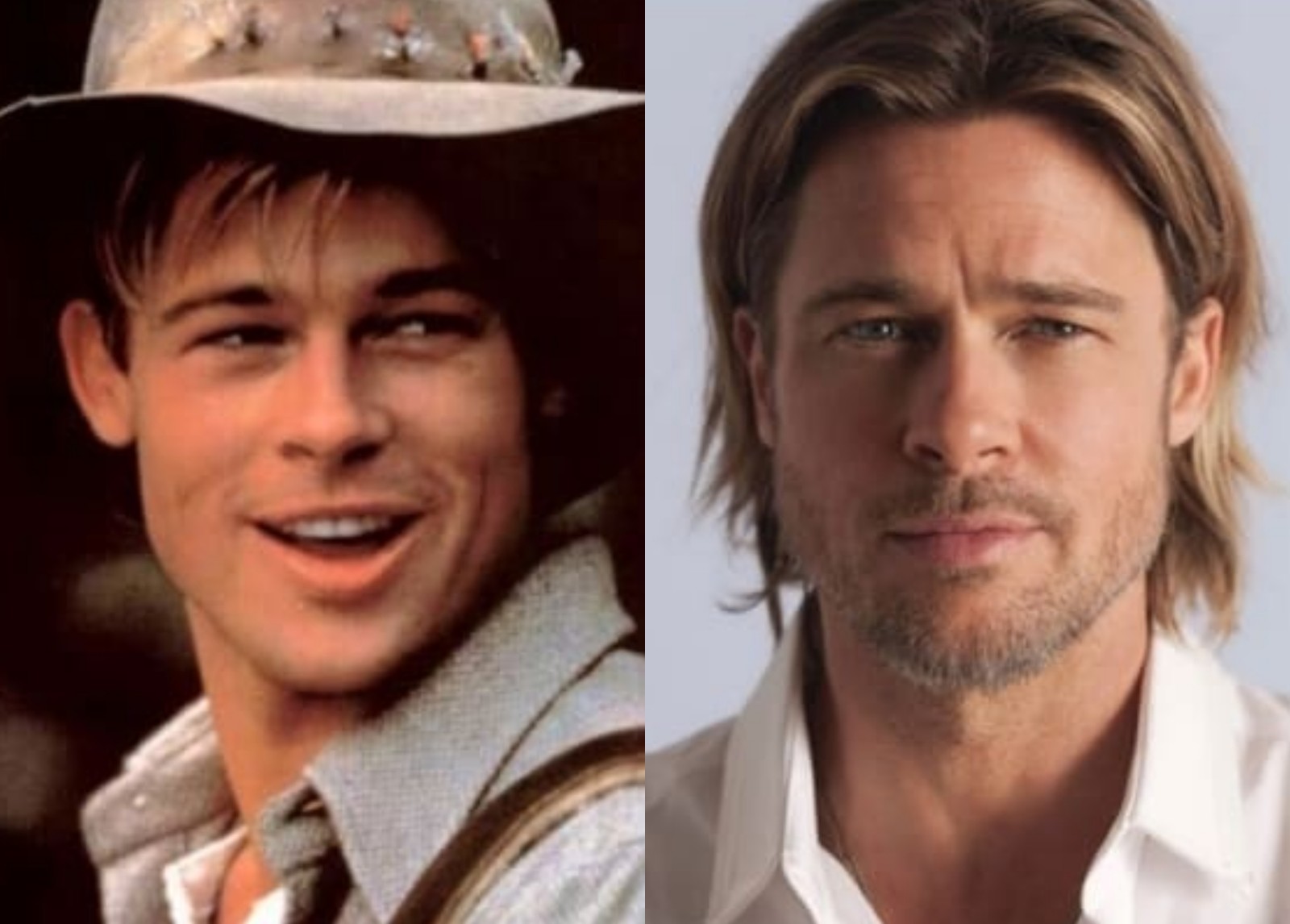 Otoplastia: antes e depois do ator Brad Pitt