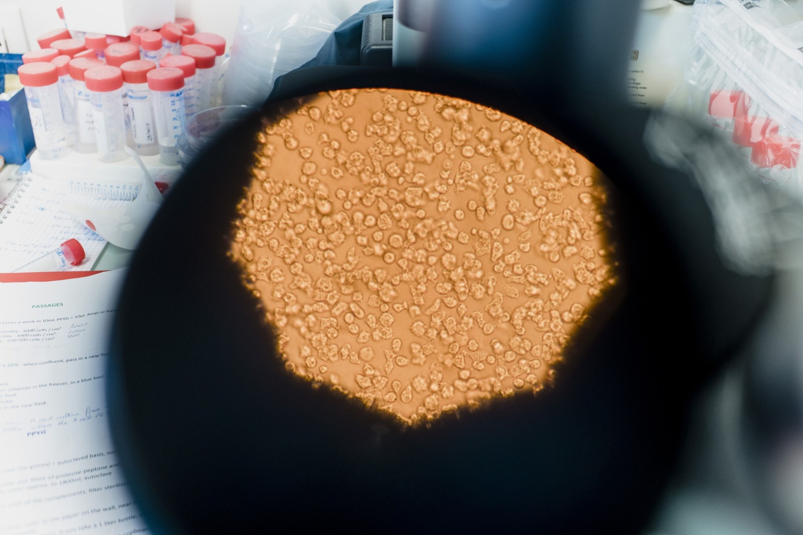 Amostra de vírus zumbi capturada por microscópio no laboratório de pesquisa — Foto: Jeremy Suykur/Bloomberg