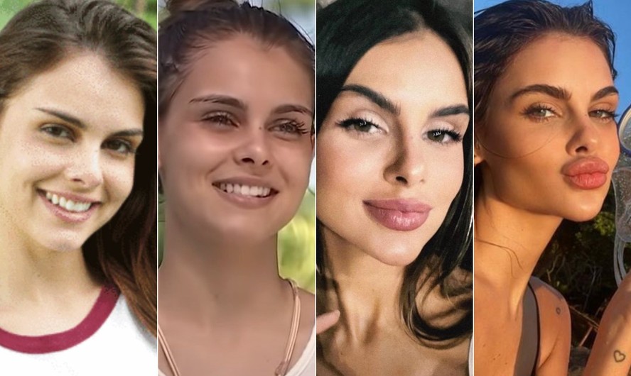 Antes e depois: Amanda Kimberlly, mãe de Helena, filha de Neymar, se submeter a vários procedimentos estéticos e mudou completamente a aparência do rosto