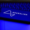 Neuralink, a startup de Musk, está desenvolvendo um pequeno dispositivo que conectará o cérebro a um computador - Bloomberg