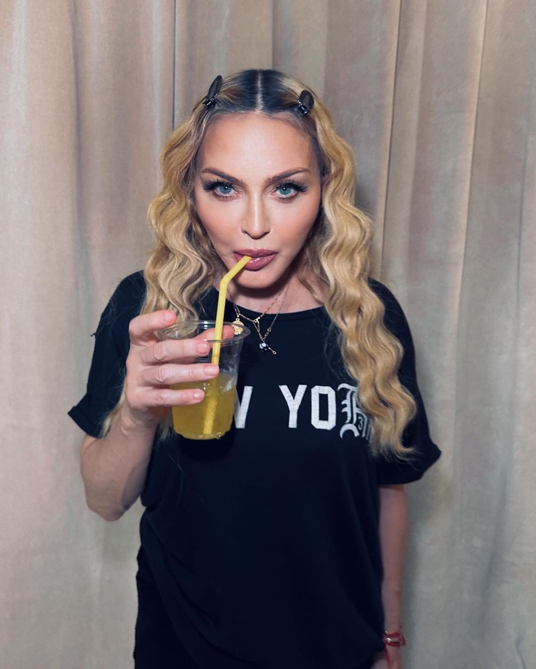 Madonna já apostou na soroterapia — Foto: Reprodução Instagram  