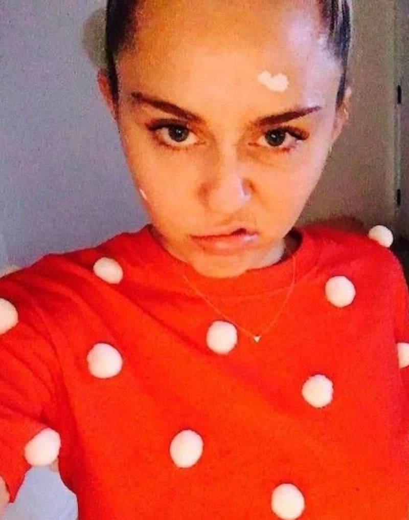 Miley Cyrus já enfrentou problema com acne — Foto: Reprodução Instagram