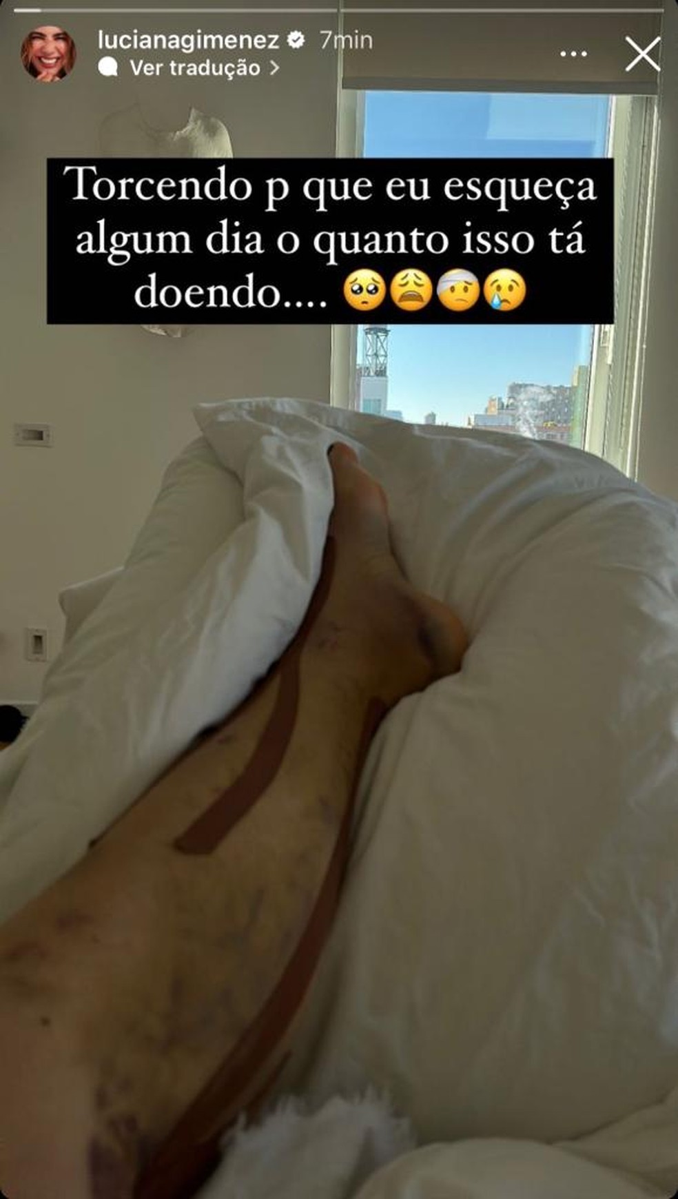 Luciana Gimenez mostra imagem de sua perna e fala sobre dor intensa — Foto: Reprodução/Instagram