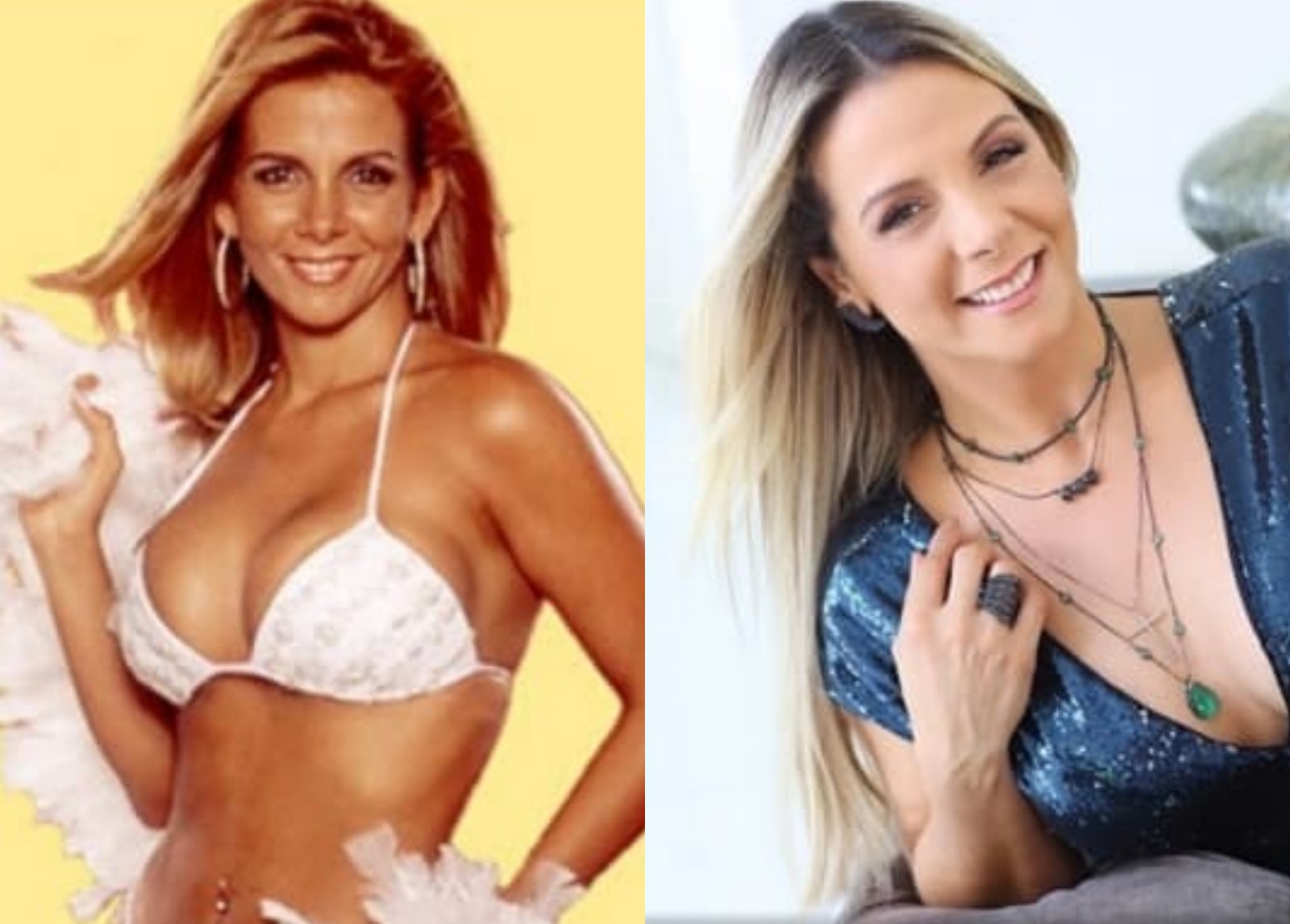 Otoplastia: antes e depois da ex-dançarina Carla Perez