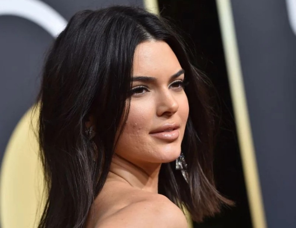 Kendall Jenner já enfrentou problema com acne — Foto: Getty Images