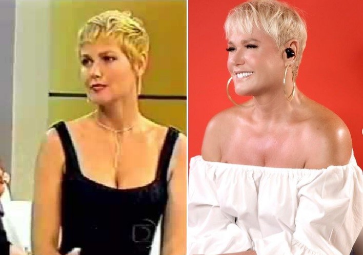 Xuxa contou que se arrepende de ter implantado silicone após o nascimento de Sasha, hoje com 23 anos. Ela revelou que os médicos colocaram próteses maiores do que as que ela queria e fizeram botox sem seu consentimento