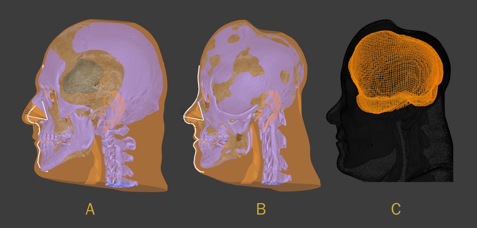 Estudo e análise cerebral realizada por pesquisadores e cientistas internacionais — Foto: Reprodução