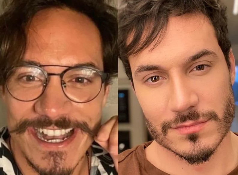 Eliezer mostra antes e depois de procedimentos estéticos. Ele fez implante capilar e de barba, passou por uma rinoplastia e retocou a harmonização facial — Foto: Reprodução/Instagram