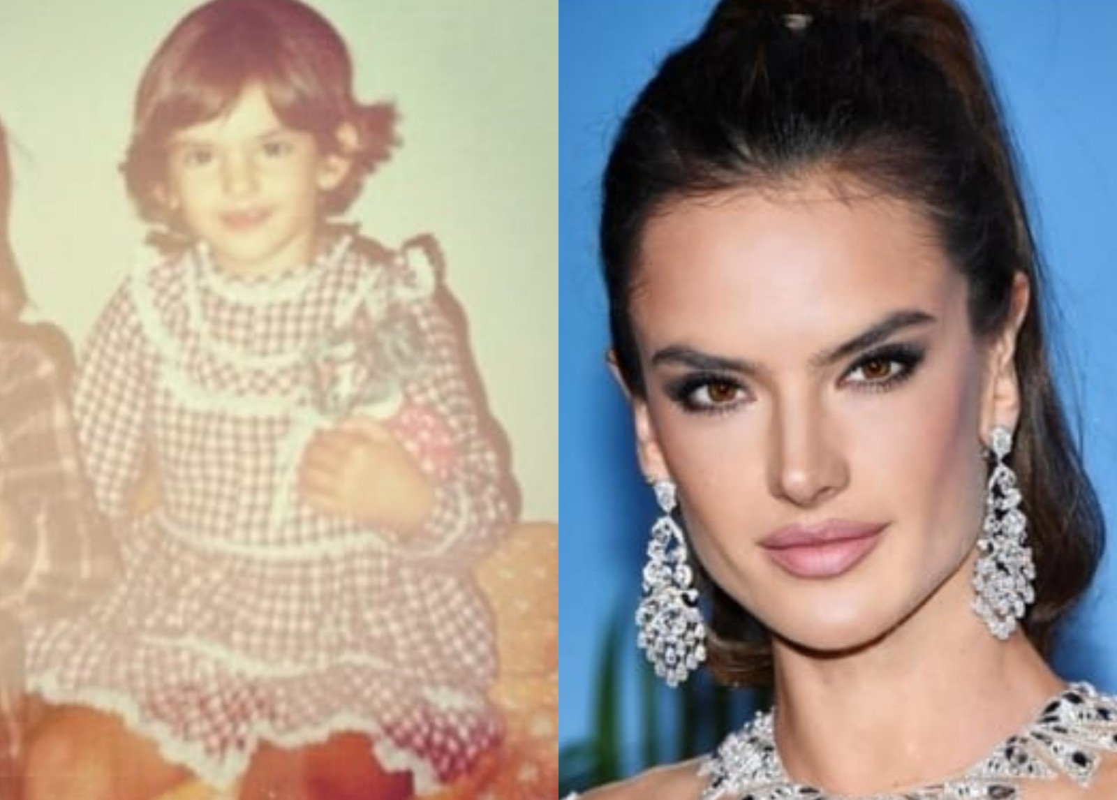 Otoplastia: antes e depois da modelo Alessandra Ambrosio