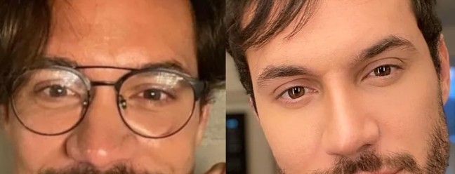 Eliezer mostra antes e depois de procedimentos estéticos. Ele fez implante capilar e de barba, passou por uma rinoplastia e retocou a harmonização facial — Foto: Reprodução/Instagram