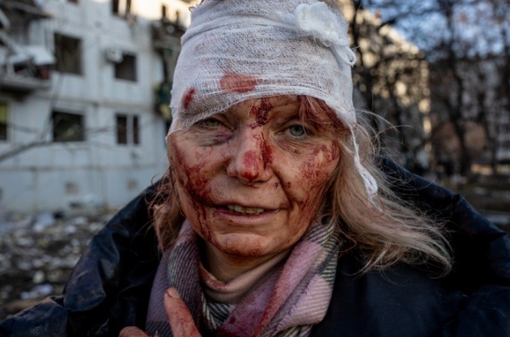 “Olena Curillo: Face da Guerra da Ucrânia”, do americano Wolfgang Schwan. Nela, uma mulher aparece em estado de choque e coberta de sangue depois que seu complexo de apartamentos foi atingido por um míssil russo — Foto: Wolfgang Schwan/Siena International Photo Awards