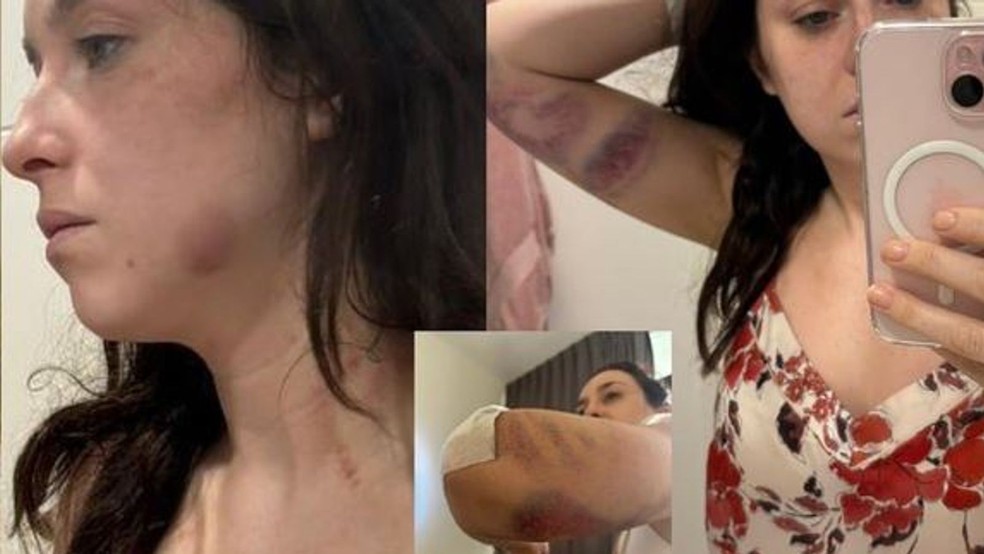 Tori alega ter sido agredida pelo marido — Foto: Reprodução/Detained in Dubai