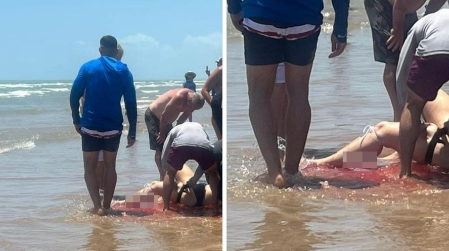 Mulher fica gravemente ferida após ser atacada por tubarão no Texas