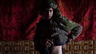 Jovem afegão que vendeu seu rim para salvar a família da fome mostra cicatrizes da operação, em sua casa, no distrito de Injil, na província de Herat, em 4 de fevereiro..  — Foto: Wakil KOHSAR / AFP