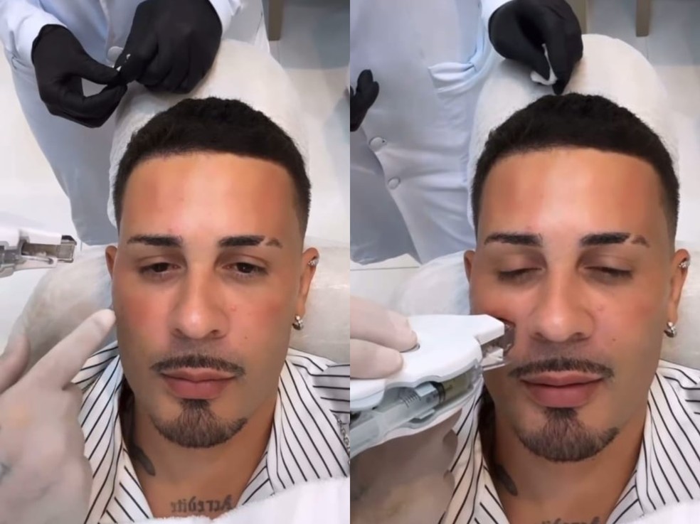 Entenda como funciona facial com esperma de salmão realizado por Carlinhos Maia — Foto: Reprodução Instagram