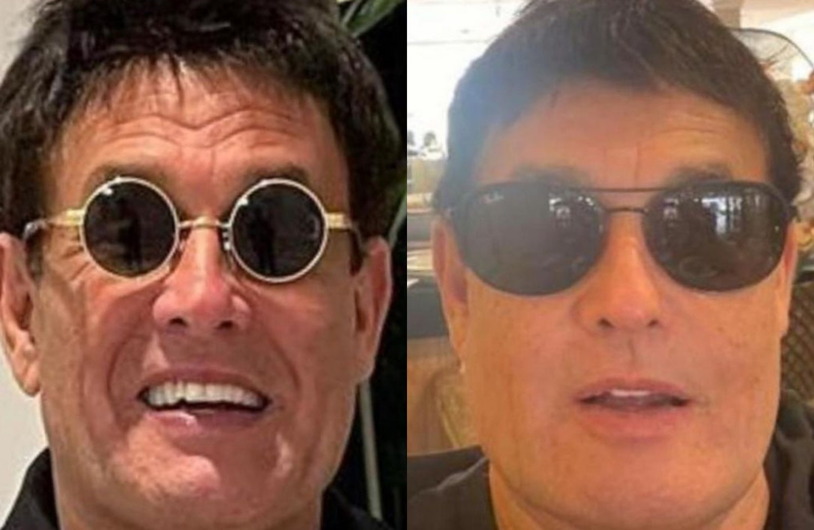 Harmonização facial: antes e depois de Sérgio Malandro — Foto: Reprodução Instagram