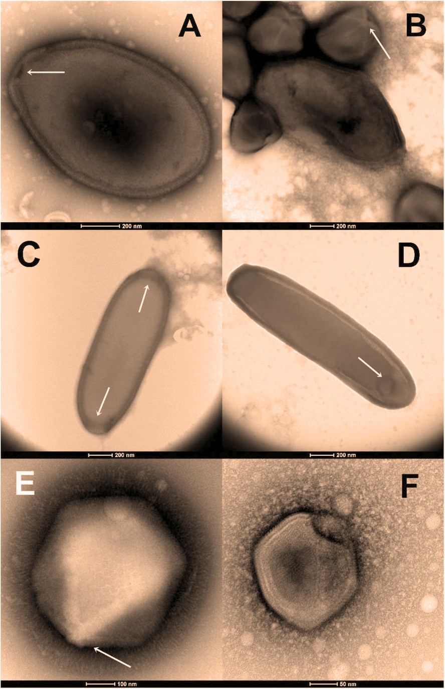 ( A ) A grande partícula ovóide dos Pandoravírus ( B ) Uma mistura de partículas de Pandoravírus e Megavírus ( C ) A partícula alongada de um Cedratvírus ( D ) A partícula alongada de um Pithovirus ( E ) A grande partícula de um megavírus ( F ) A partícula típica de Asfarvírus/Pacmanvírus.