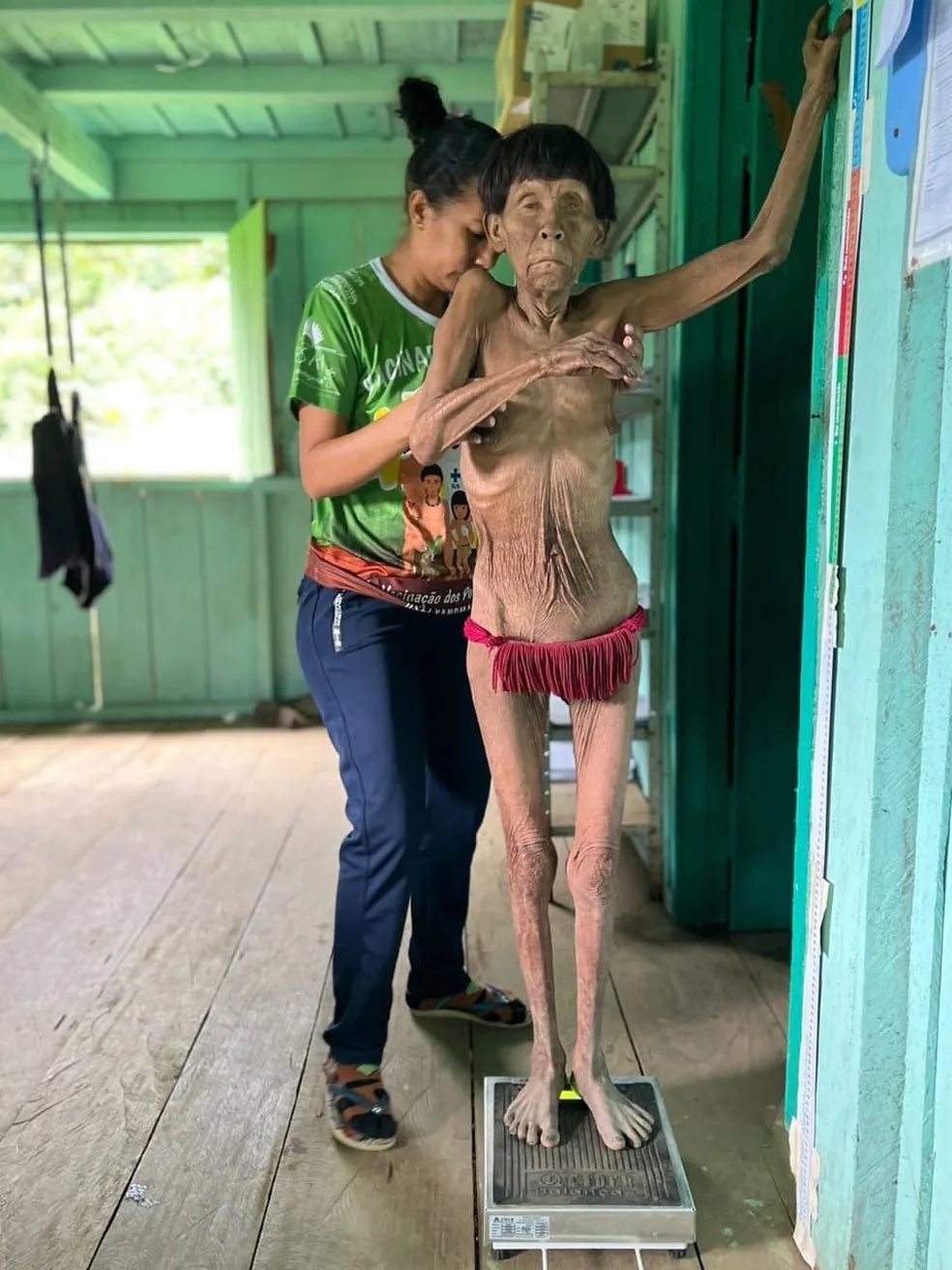 Profissional de saúde pesa mulher ianomami com quadro severo de desnutrição — Foto:  Reprodução/Urihi Yanomami