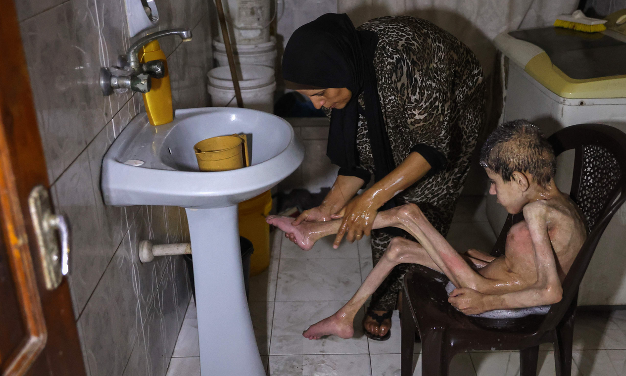 Sarna e piolho se espalham entre crianças devido às más condições de higiene em Gaza
