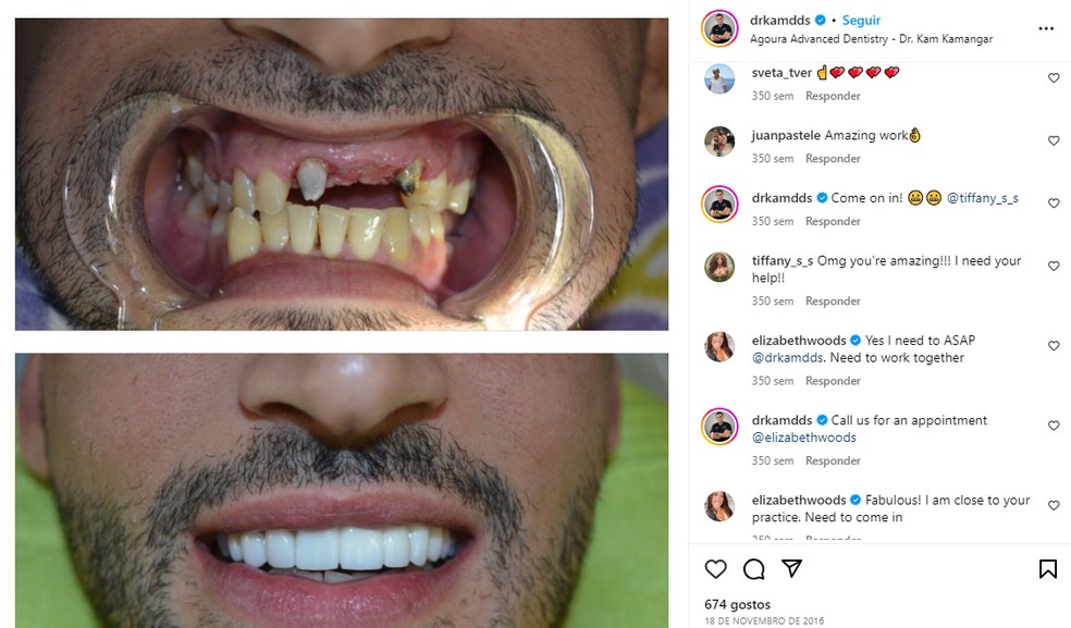 Dentista mostrou resultado de tratamento nos dentes, e internautas apontaram perfil de Sam Asghari — Foto: Reprodução/Instagram