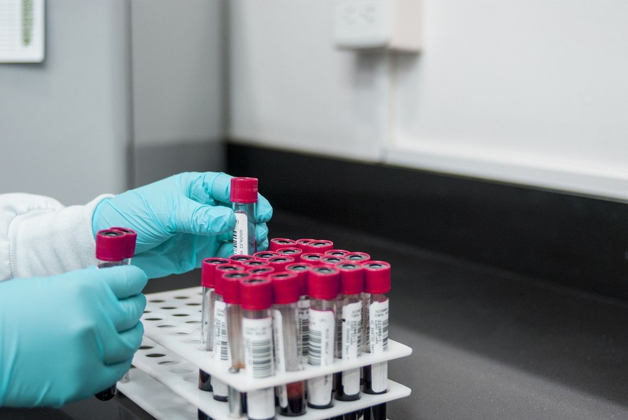 Amostras de sangue são analisadas em laboratório