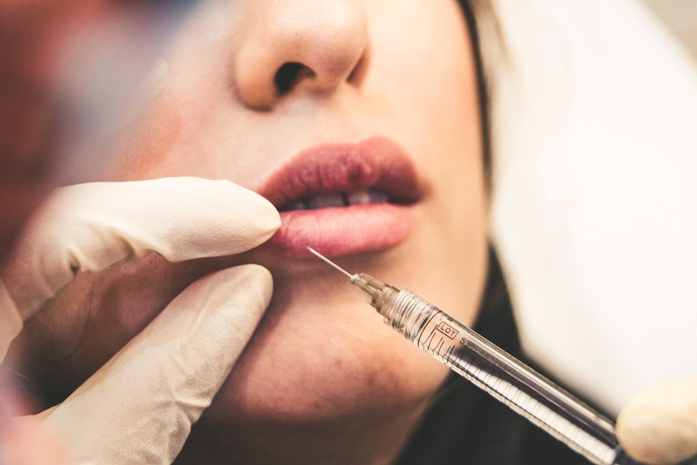 Preenchimento labial e outros procedimentos estéticos não costumam ser cobertos pelos planos de saúde — Foto: Unsplash
