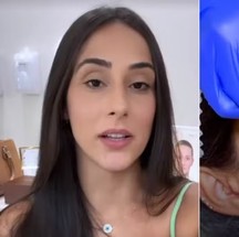 Deniziane, do 'BBB 24' fez harmonização facial — Foto: Reprodução/Instagram