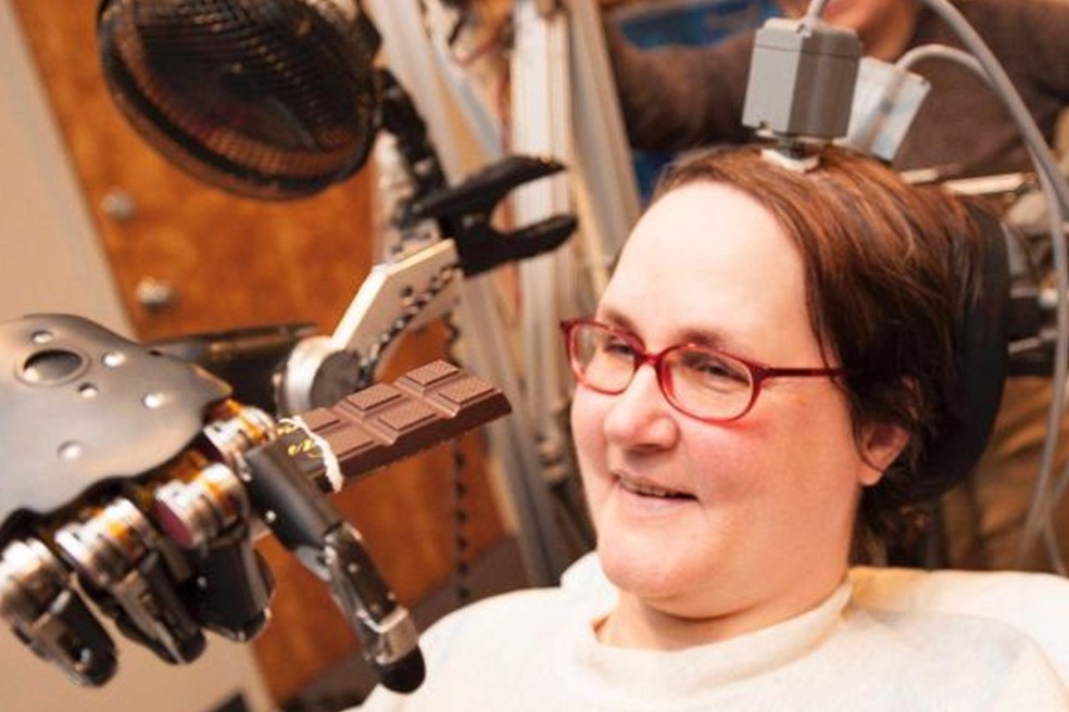 Após cirurgia para adição de um par de implantes em seu córtex motor, Jan Scheuermann passou a conseguir movimentar um braço mecânico com estímulos neurais — Foto: BCI Pioneers Coalition