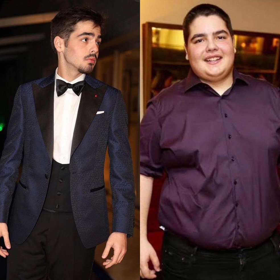 Antes e depois de João Silva, filho do apresentador Faustão — Foto: Reprodução Instagram