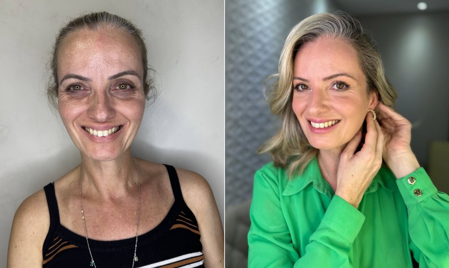 A administradora Ana Paula Braz, de 47 anos: 'antes e depois' do peeling de fenol