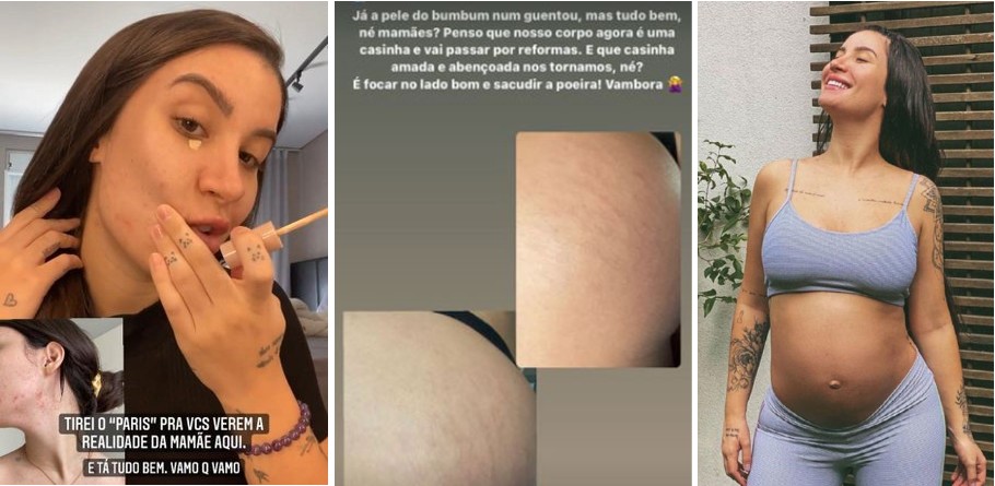 A influenciadora e ex-"BBB" Bianca Andrade compartilhou todas as fases da sua gravidez e do puerpério nas redes. Ela falou de temas delicados como surgimento de acne no rosto e estrias no bumbum, além de diástase abdominal. Seu filho, Cris, está com quase 2 anos— Foto: Reprodução/Instagram