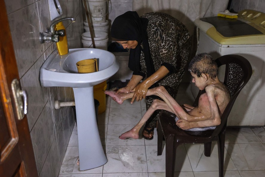 Sahar, mãe do palestino Bahaa al-Nimr, 19 anos, que sofre de paralisia cerebral e desnutrição, lava seu filho com pouca água em sua casa no bairro de Sheikh Radwan, na Cidade de Gaza