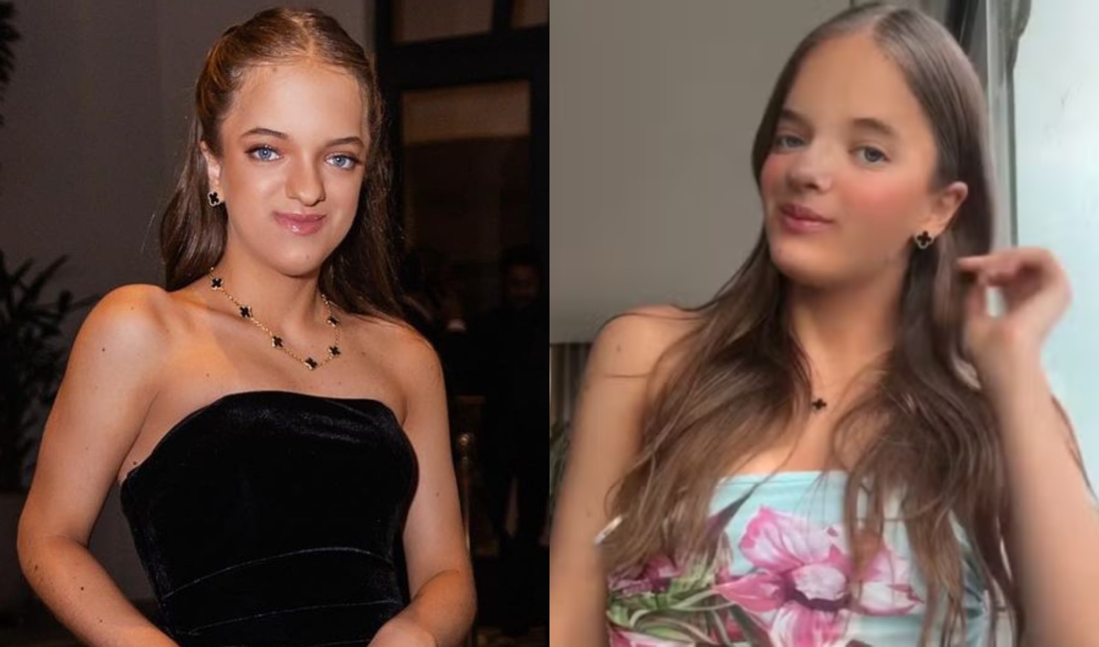 Antes e depois da rinoplastia de Rafaella Justus — Foto: Reprodução Instagram 